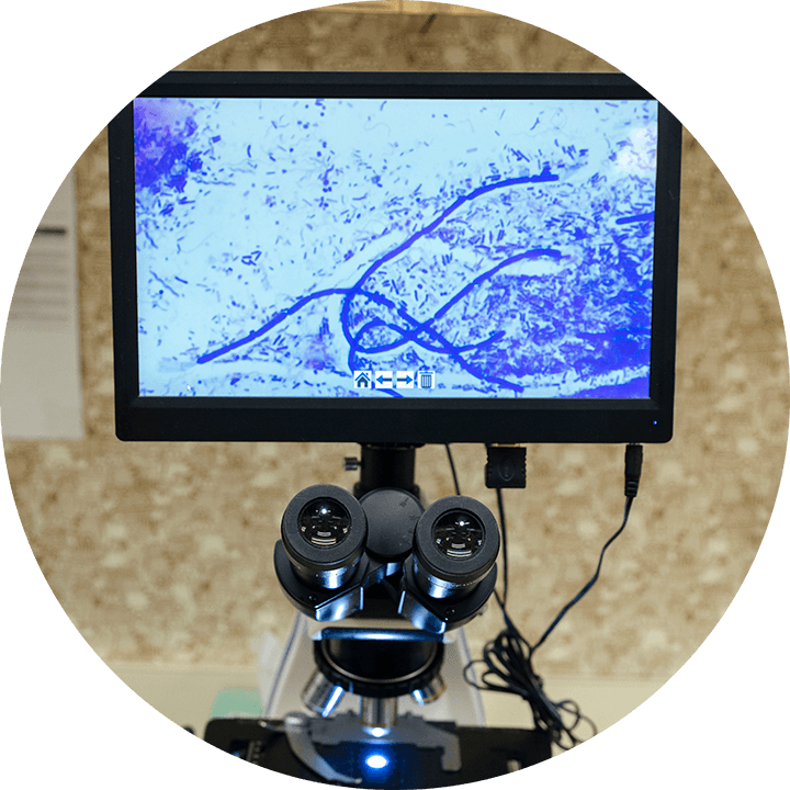 Fecal Testing