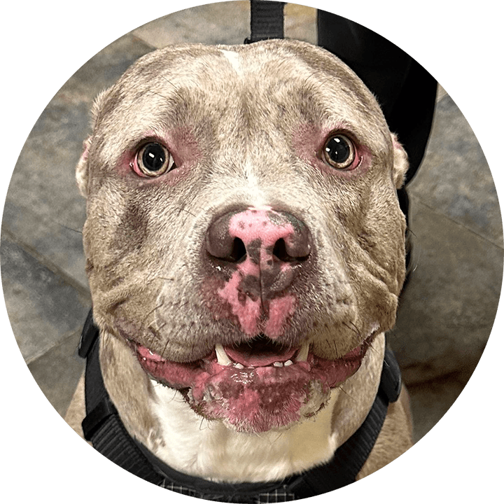 Feeding Tube Placement